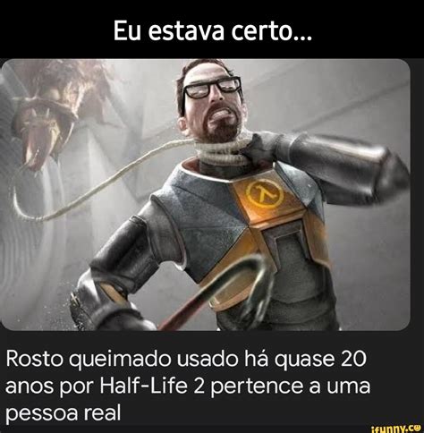 Rosto queimado usado há quase 20 anos por Half。